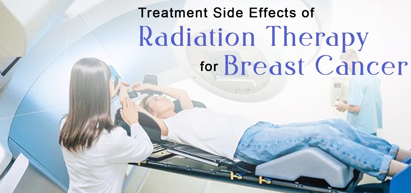 Side Effects of Radiation Therapy for Breast Cancer