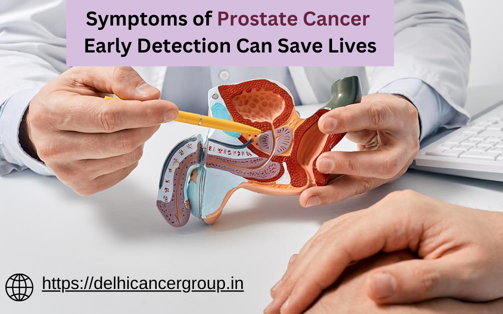 Symptoms of Prostate Cancer: Early Detection Can Save Lives