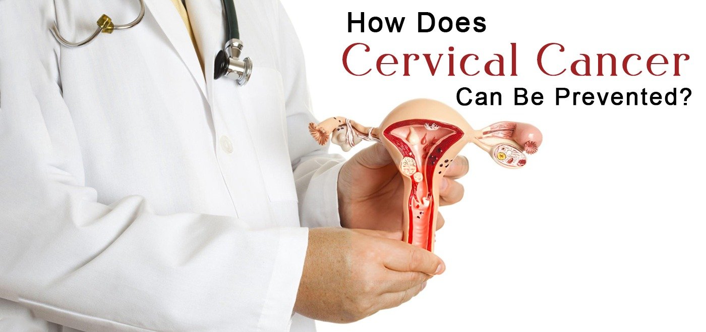 How Does Cervical Cancer Can Be Prevented?